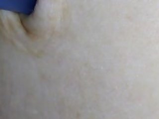 Pen cap in my belly button part 3