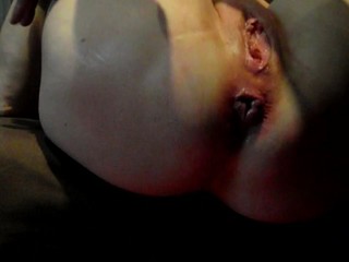 nice prolapsette by anal mature